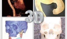 갈길 먼 국내 3D프린팅 의료기술 