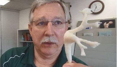 3D프린팅 모델을 이용하여 롤러코스터의 신장결석 배출 효과 시험