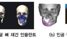 제4차 산업혁명과 3D프린팅 3편 - 3D프린팅 기술과 인간의 건강 