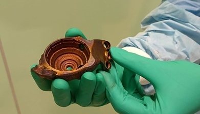 폴란드 최초 3D프린트 인공고관절  수술